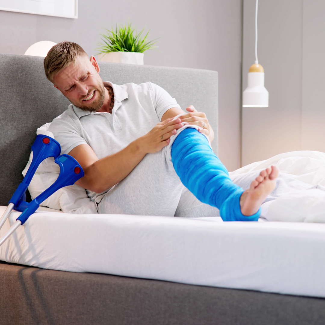 Man With Broken Leg Fracture Injury And Cast