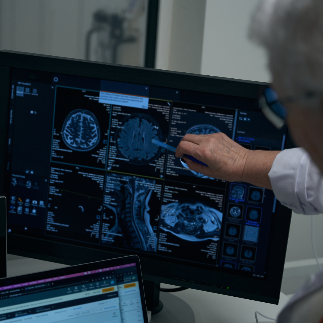 Elderly female doctor and her colleague reviewing brain CT scan results