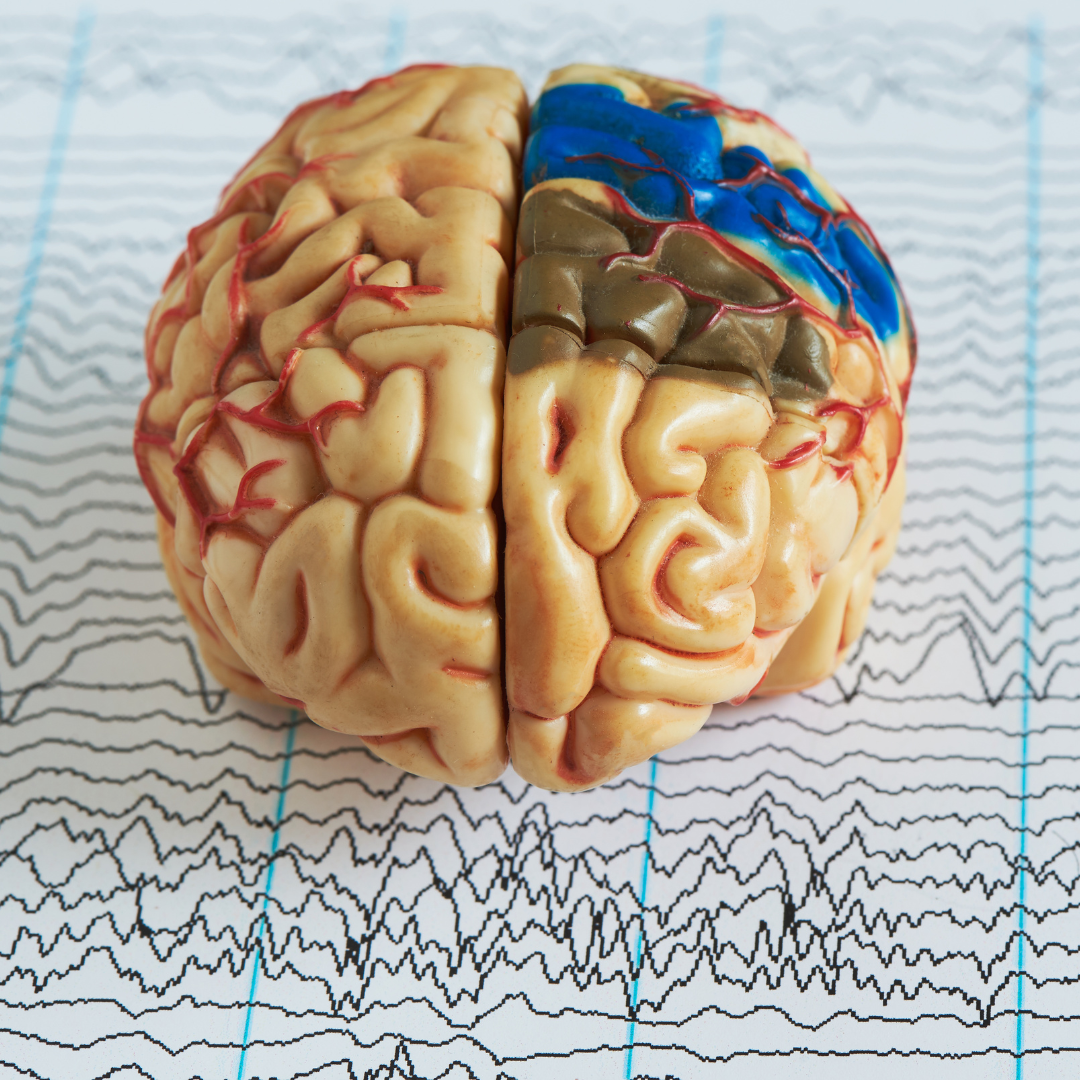 Brain model on human brain wave background