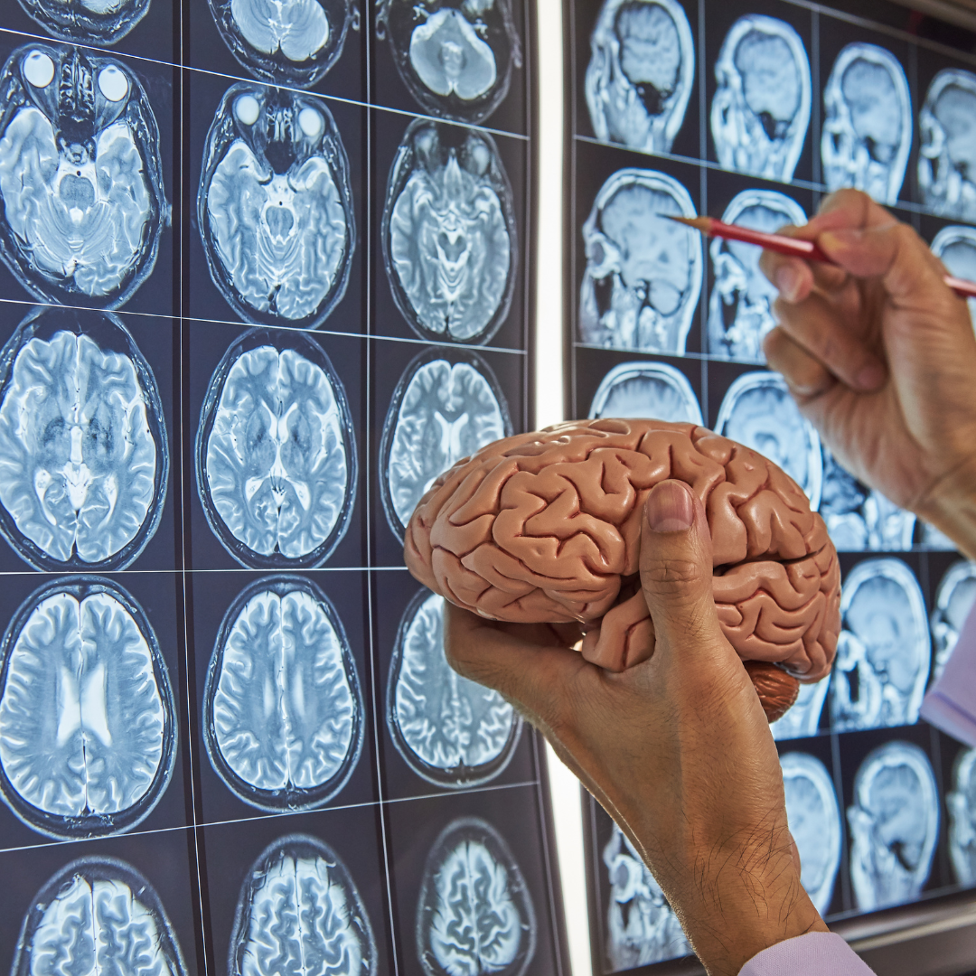 A neurosurgeon holding brain model and pointing at brain MRI